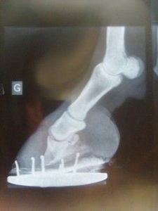 radiographie du pied du cheval avec bascule de la troisième phalange
